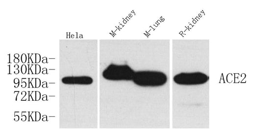 Western Blot analysis of various samples using ACE2 Polyclonal Antibody at dilution of 1:1000.