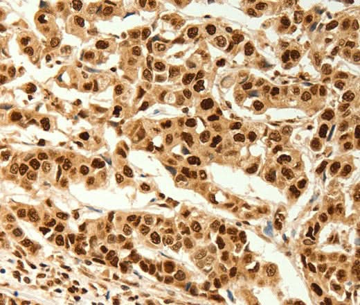 Anti-Human C12orf5 Antibody - ABMIUM