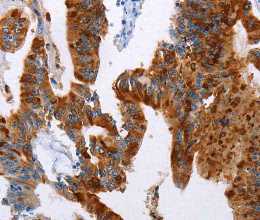 Anti-Human TFF3 Antibody