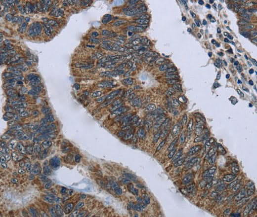 Anti-Human GYPC Antibody - ABMIUM