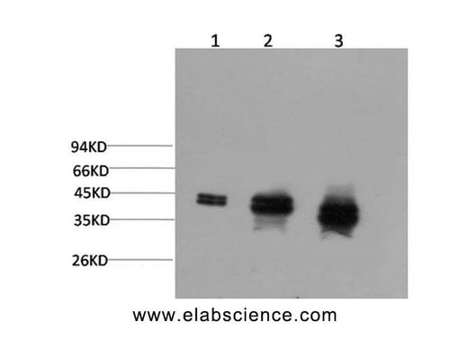 Western Blot analysis of 1) Hela, 2)Mouse brain, 3) Rat brain using ERK 1/2 Monoclonal Antibody at dilution of 1:2000.