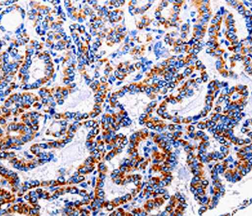 Anti-Human NFκB-p105 Antibody