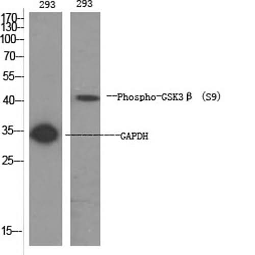 Western Blot analysis of 293 cells using Phospho-GSK3 beta (Ser9) Polyclonal Antibody at dilution of 1:1000
