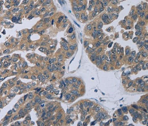 Anti-Human TP53AIP1 Antibody - ABMIUM