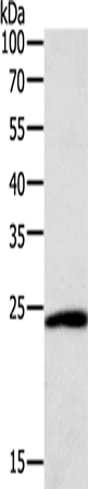 Anti-Human/Mouse/Rat SNAP25 Antibody - ABMIUM