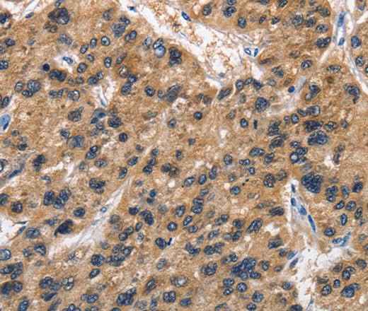Anti-Human ABI3BP Antibody - ABMIUM