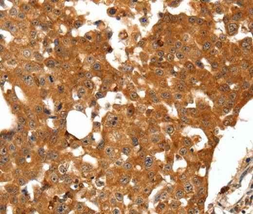 Anti-Human/Mouse/Rat SSTR1 Antibody