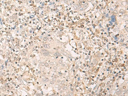 Anti-Human EPSTI1 Antibody - ABMIUM