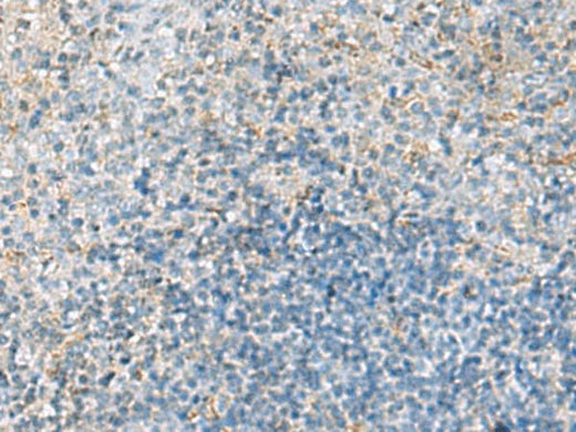 Immunohistochemistry of paraffin-embedded Human tonsil tissue using EMILIN1 Polyclonal Antibody at dilution of 1:70(×200)