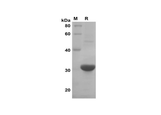 SDS-PAGE analysis of GFP proteins, 2 μg/lane of Recombinant GFP proteins was resolved with SDS-PAGE under reducing conditions, showing bands at 30 kDa.