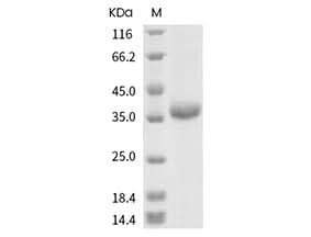 Recombinant SARS-CoV-2 Spike RBD(G485S)(His Tag) - ABMIUM