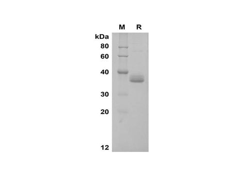 SDS-PAGE analysis of Human Apolipoprotein E/ApoE proteins, 2 μg/lane of Recombinant Human Apolipoprotein E/ApoE proteins was resolved with SDS-PAGE under reducing conditions, showing bands at 36 kDa.