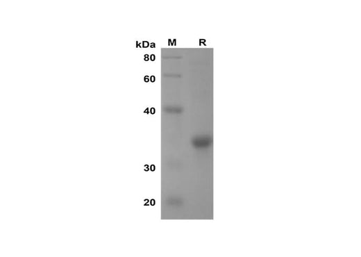 SDS-PAGE analysis of Mouse TNF-α proteins, 2 μg/lane of Recombinant Mouse TNF-α proteins was resolved with SDS-PAGE under reducing conditions, showing bands at 35 kDa.