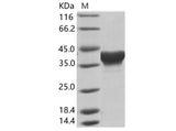 Recombinant EBOV (subtype Zaire, strain H.sapiens-wt/GIN/2014/Kissidougou-C15) Matrix protein VP40 Protein (His Tag) - ABMIUM