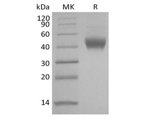 Recombinant Human IL-7 Receptor Subunit alpha/IL-7RA/CD127 (C-6His) - ABMIUM