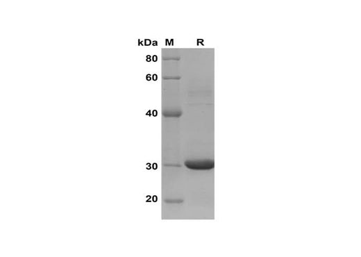 SDS-PAGE analysis of Human CCL18/PARC proteins, 2 μg/lane of Recombinant Human CCL18/PARC proteins was resolved with SDS-PAGE under reducing conditions, showing bands at 30 kDa.