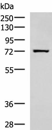 Western blot analysis of Human fetal liver tissue lysate using SHTN1 Polyclonal Antibody at dilution of 1:600