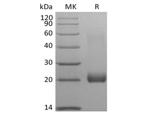 Recombinant Human Leukocyte-associated Immunoglobulin-like Receptor 2/ LAIR2/CD306 (C-Avi-6His) Biotinylated - ABMIUM