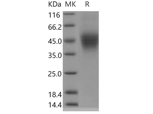 Recombinant Human FcERI/FCER1A Protein (His Tag) - ABMIUM