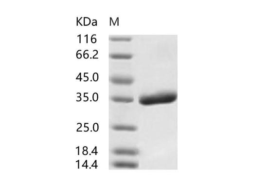 Recombinant SARS-CoV Spike/RBD Protein (RBD, His Tag), Biotinylated - ABMIUM