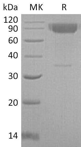Recombinant Mouse IL-2RG/CD132 Protein (Fc Tag) - ABMIUM