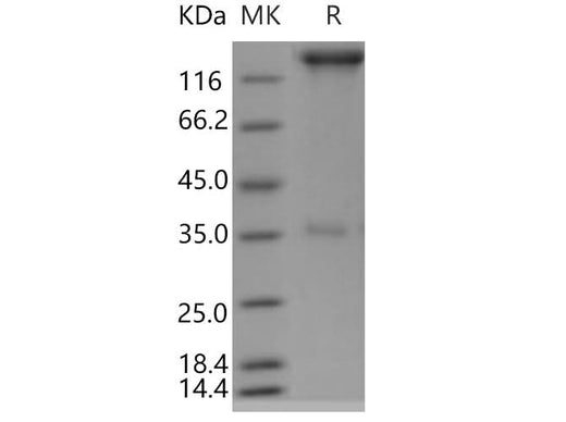 > 85 % as determined by reducing SDS-PAGE.