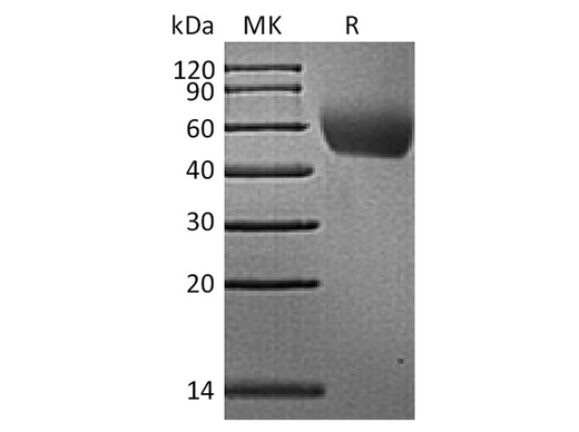 Recombinant Rhesus macaque CD155/PVR/NECL5 Protein (His Tag) - ABMIUM