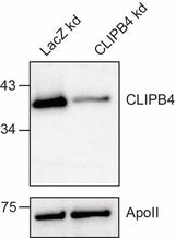 Anti-African malaria mosquito CLIPB4 Antibody Boster Bio