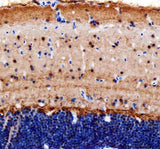 Anti-Zebrafish Cops8 Antibody Boster Bio