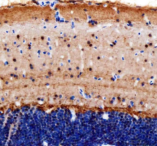 Anti-Zebrafish Cops8 Antibody Boster Bio