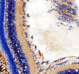 Anti-Zebrafish hsd17b14 Antibody Boster Bio