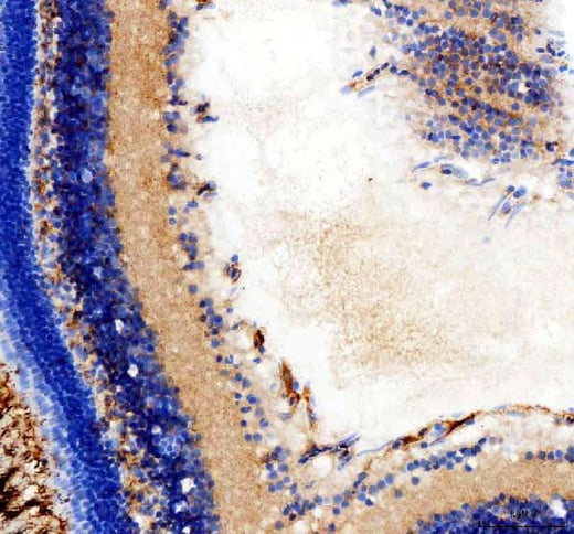 Anti-Zebrafish hsd17b14 Antibody Boster Bio