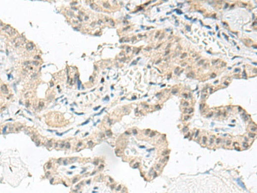 Anti-Human GFI1B Antibody - ABMIUM