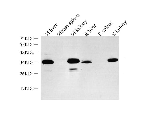 Western Blot analysis of various samples using EPO Polyclonal Antibodyat dilution of 1:1000.