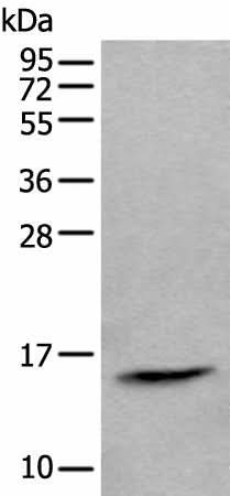 Western blot analysis of Human lymph gland tissue lysate using CCL21 Polyclonal Antibody at dilution of 1:600