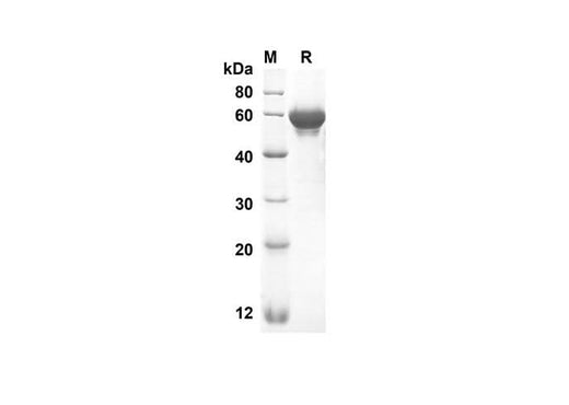 SDS-PAGE analysis of Mouse Lbp proteins, 2 μg/lane of Recombinant Mouse Lbp proteins was resolved with an SDS-PAGE under reducing conditions, showing bands at 52.8 kDa.