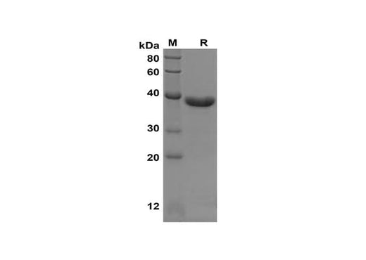 SDS-PAGE analysis of Human IL-11 proteins, 2 μg/lane of Recombinant Human IL-11 proteins was resolved with SDS-PAGE under reducing conditions, showing bands at 38 kDa.