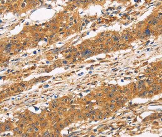 Anti-Human CD22 Antibody