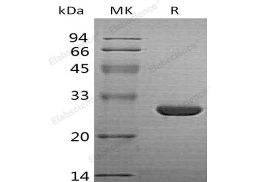 Recombinant Human HO-1/HMOX1 Protein - ABMIUM