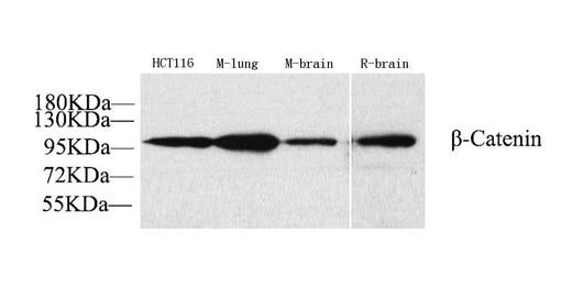 Western Blot analysis of various samples using Catenin beta Polyclonal Antibody at dilution of 1:1000.