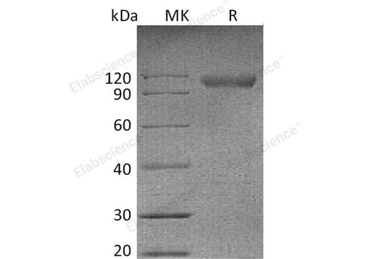 Recombinant Mouse NgR/RTN4R Protein (Fc Tag) - ABMIUM