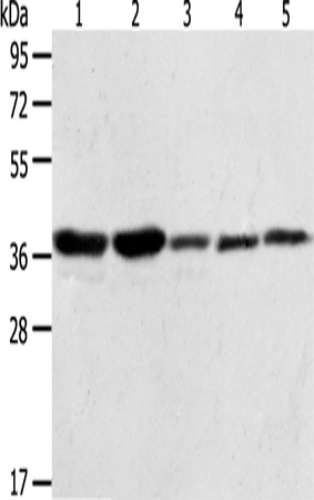 Anti-Human/Mouse/Rat ANXA1 Antibody - ABMIUM