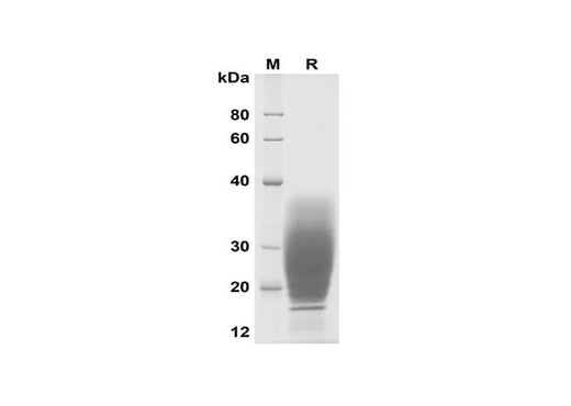 SDS-PAGE analysis of Mouse SCF proteins, 2 μg/lane of Recombinant Mouse SCF proteins was resolved with SDS-PAGE under reducing conditions, showing bands at 18-38 kDa.