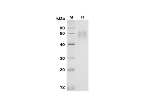 SDS-PAGE analysis of Rat Fcγ RIIB/CD32b proteins, 2 μg/lane of Recombinant Rat Fcγ RIIB/CD32b proteins was resolved with SDS-PAGE under reducing conditions, showing bands at 55-65 kDa.