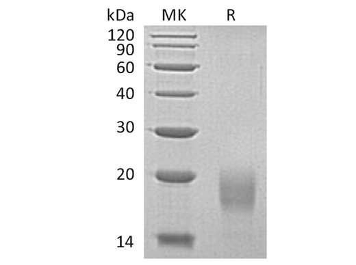 Recombinant Human ALK4/ACVR1B Protein (His Tag) - ABMIUM