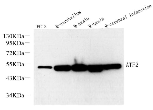 Western Blot analysis of various samples using ATF2 Polyclonal Antibody at dilution of 1:600.