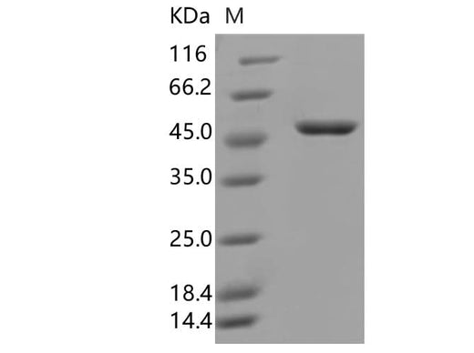 Recombinant SARS-CoV-2 N Protein (D3L,R203K,G204R,S235F)(His Tag) - ABMIUM