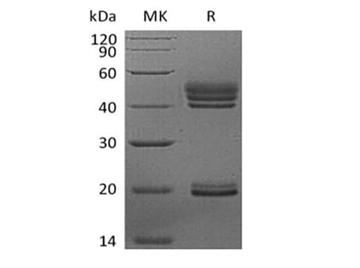 Recombinant Human Interleukin-23/IL-23 (C-6His) - ABMIUM