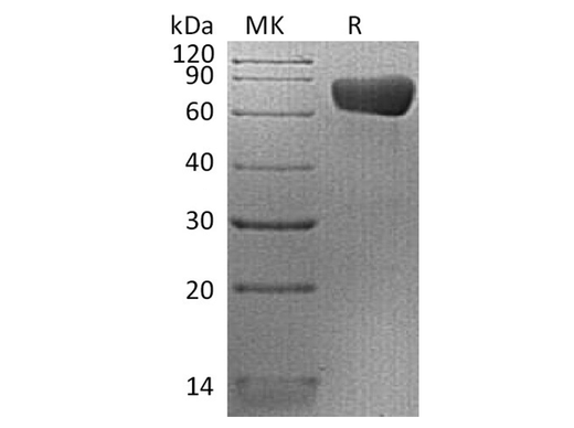 Recombinant Human PD-L2/CD273 Protein (mFc Tag) - ABMIUM