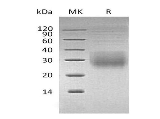 Recombinant Human NKG2A & CD94 Heterodimer Protein (His & Flag Tag) - ABMIUM